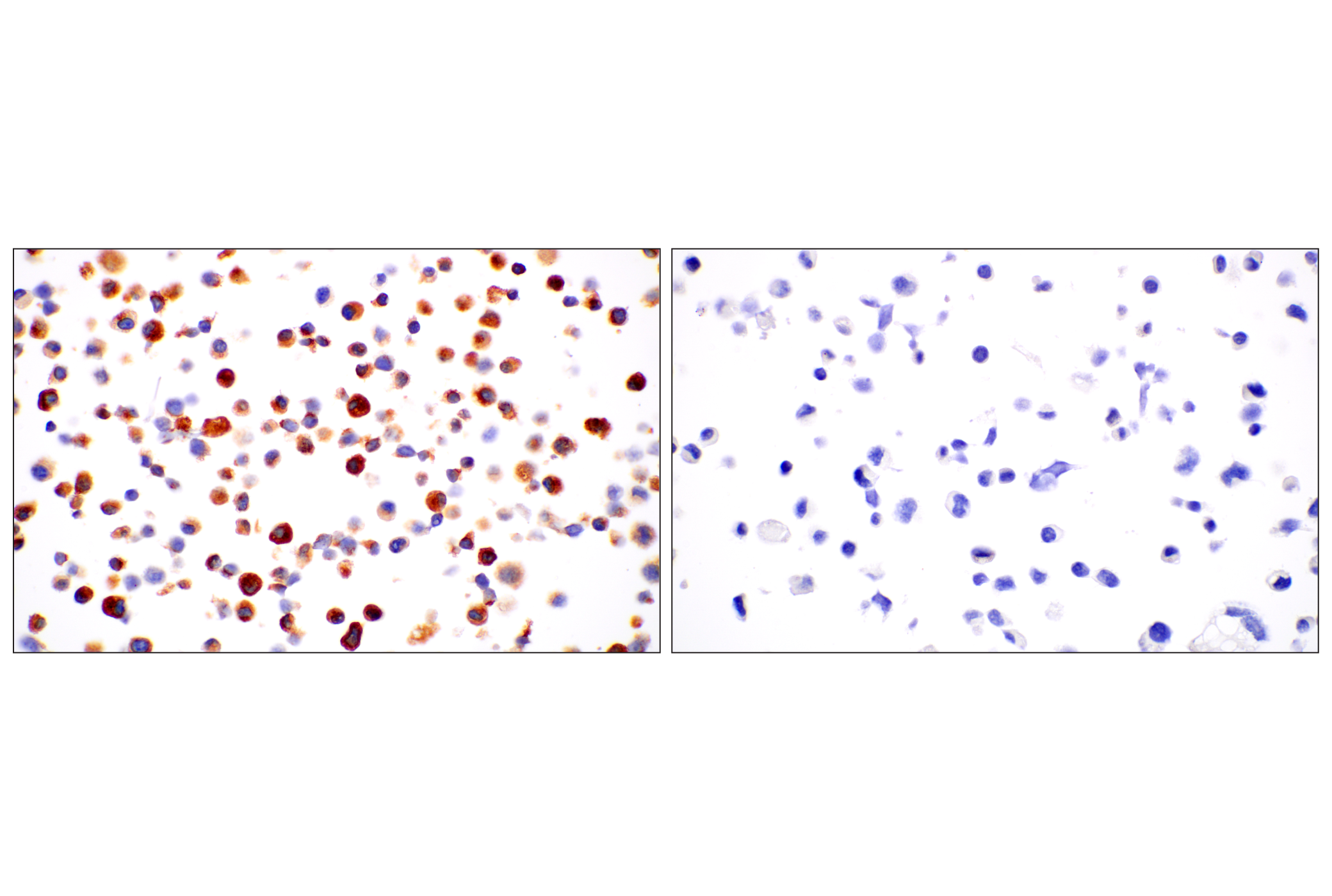 Immunohistochemistry Image 10: C1QB (E3U6X) Rabbit mAb