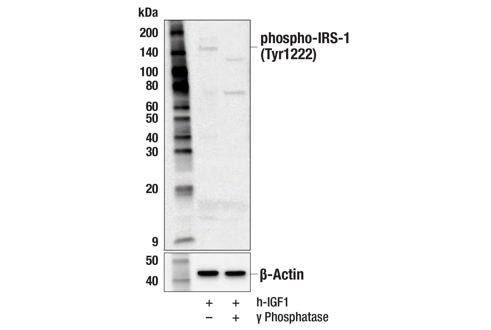 Western Blotting Image 1: Phospho-IRS-1 (Tyr1222) Antibody