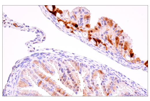 Immunohistochemistry Image 3: S100B (E9F2I) Rabbit mAb (BSA and Azide Free)
