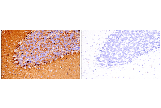Immunohistochemistry Image 5: S100B (E9F2I) Rabbit mAb (BSA and Azide Free)
