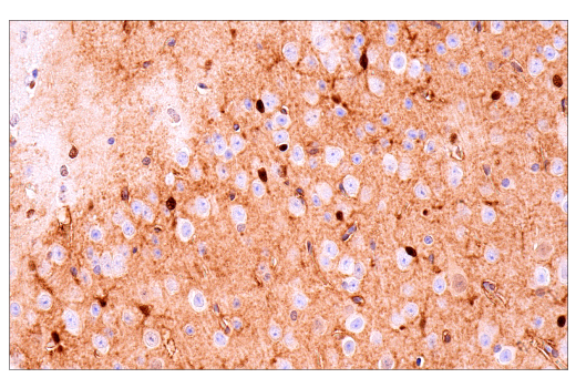 Immunohistochemistry Image 1: S100B (E9F2I) Rabbit mAb (BSA and Azide Free)