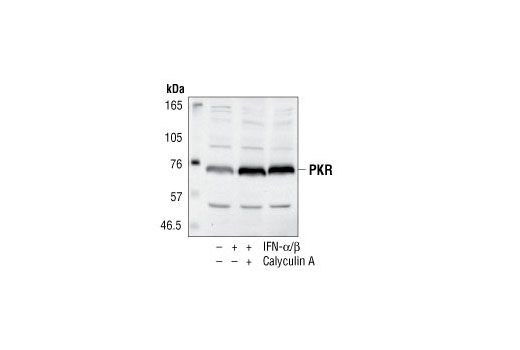 Western Blotting Image 1: PKR Antibody
