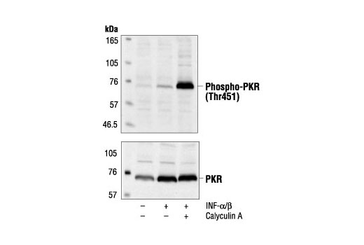 Western Blotting Image 1: Phospho-PKR (Thr451) Antibody