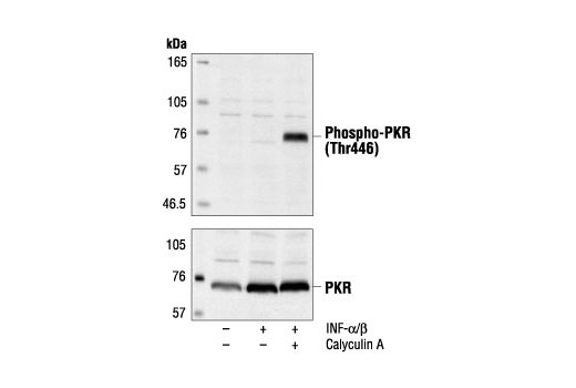 Western Blotting Image 1: Phospho-PKR (Thr446) Antibody