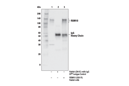 Immunoprecipitation Image 1: RBM10 (E6I1R) Rabbit mAb