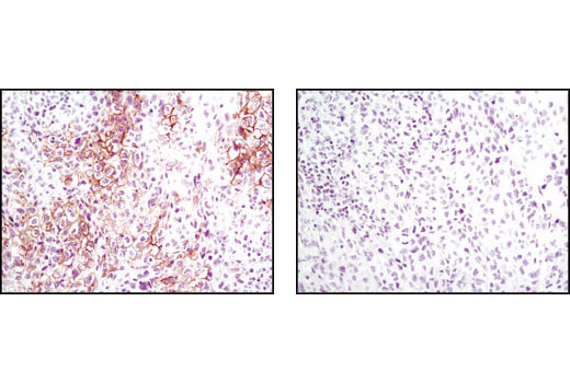  Image 5: PhosphoPlus® Met (Tyr1234/Tyr1235) Antibody Duet