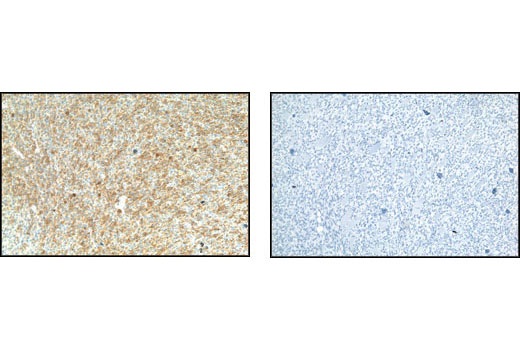 Immunohistochemistry Image 2: Phospho-Met (Tyr1234/1235) (D26) XP® Rabbit mAb