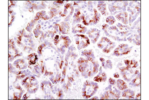 Immunohistochemistry Image 6: Phospho-Met (Tyr1234/1235) (D26) XP® Rabbit mAb