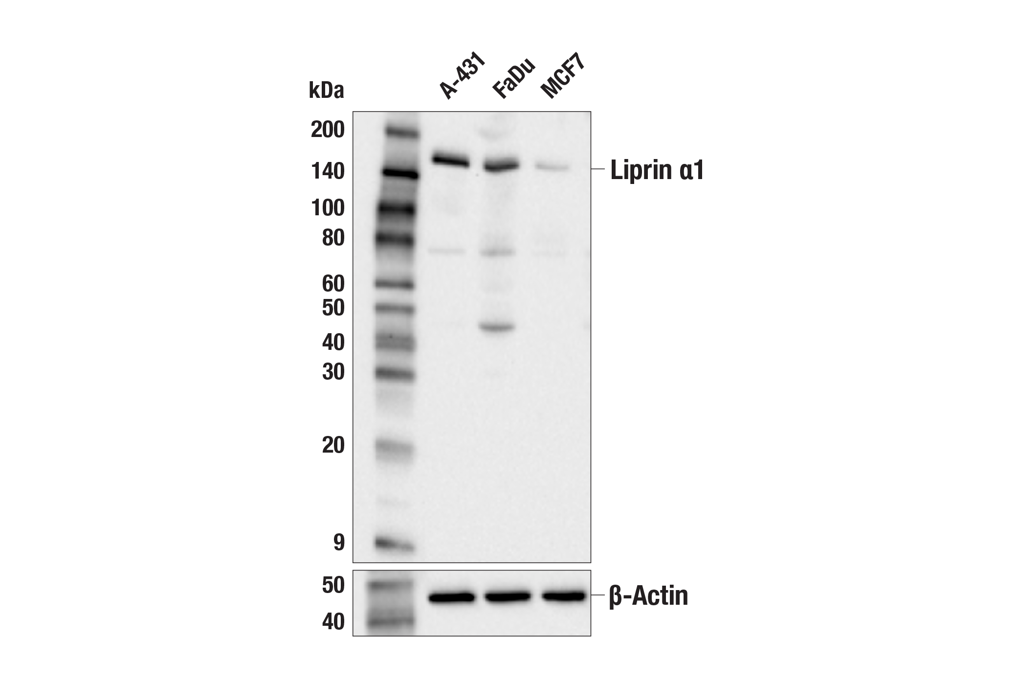 Western Blotting Image 1: Liprin α1 (E7D7W) Rabbit mAb