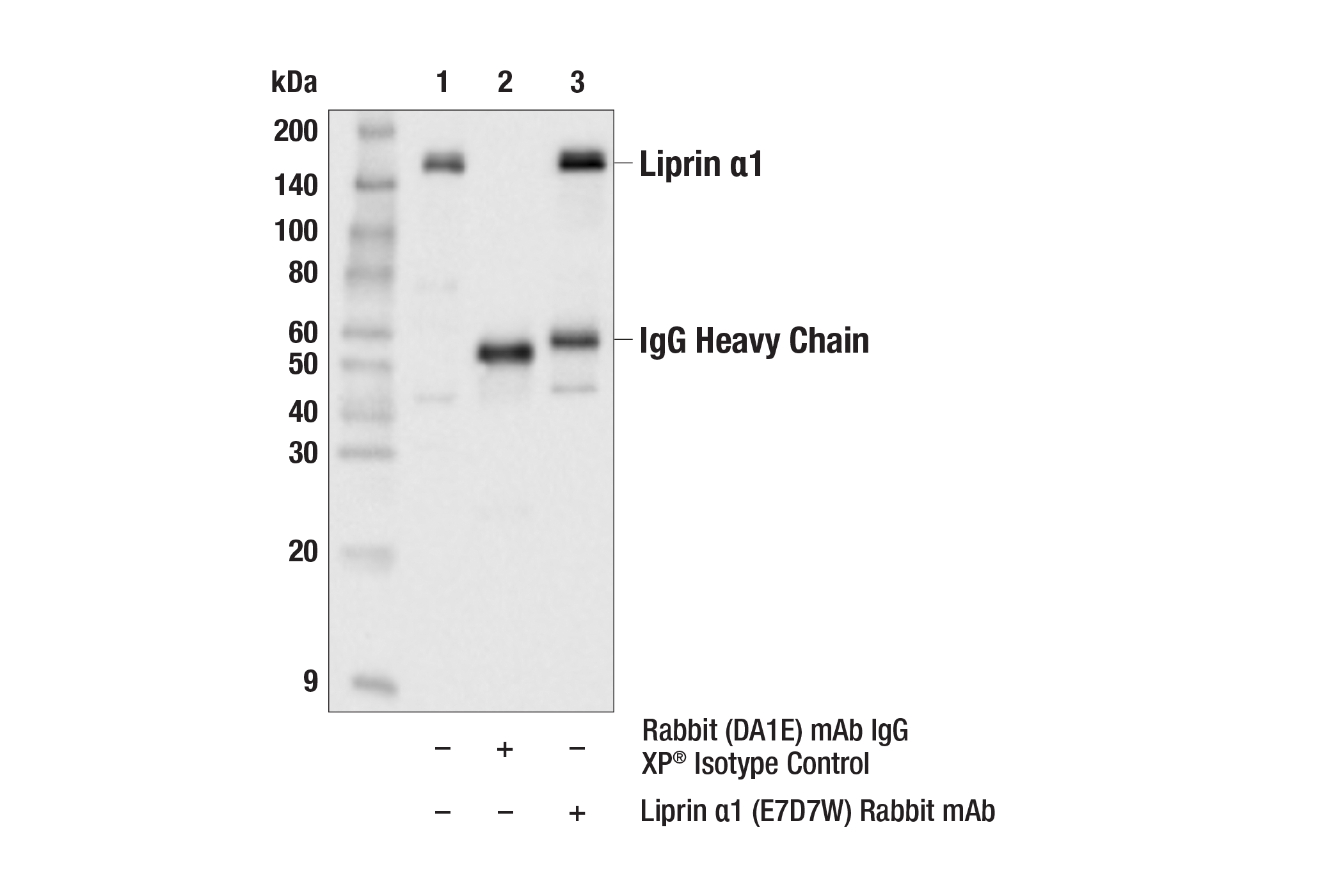 Immunoprecipitation Image 1: Liprin α1 (E7D7W) Rabbit mAb