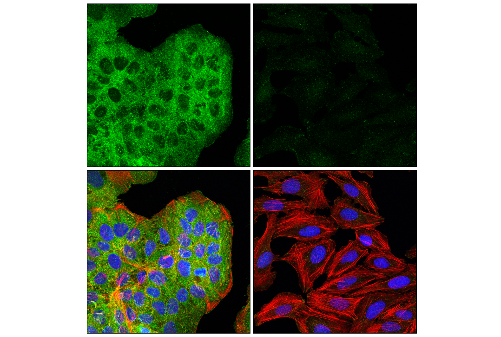 Immunofluorescence Image 1: Liprin α1 (E7D7W) Rabbit mAb