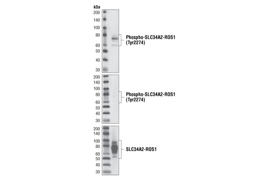 Western Blotting Image 1: Phospho-ROS1 (Tyr2274) Antibody