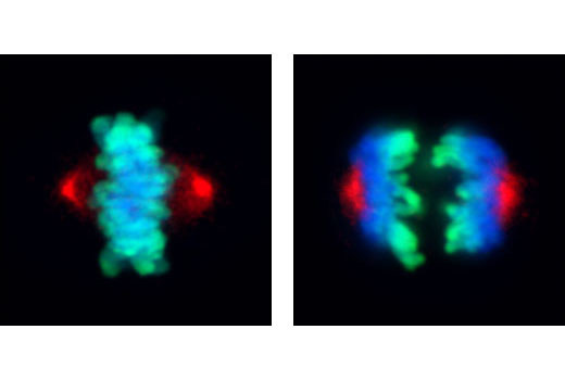 Immunofluorescence Image 1: Phospho-Aurora A (Thr288) (C39D8) Rabbit mAb