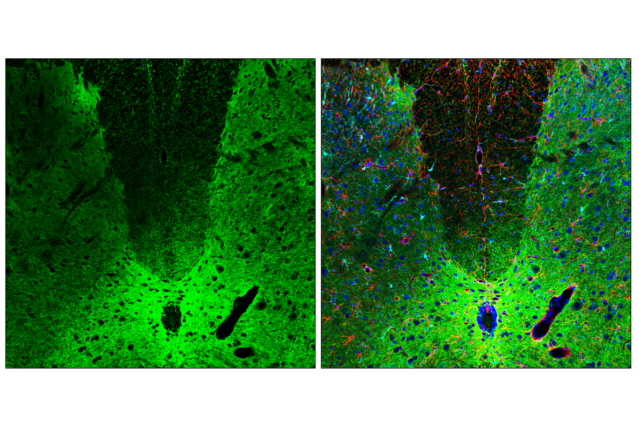 Immunofluorescence Image 1: GAP43 (E1U1D) Mouse mAb