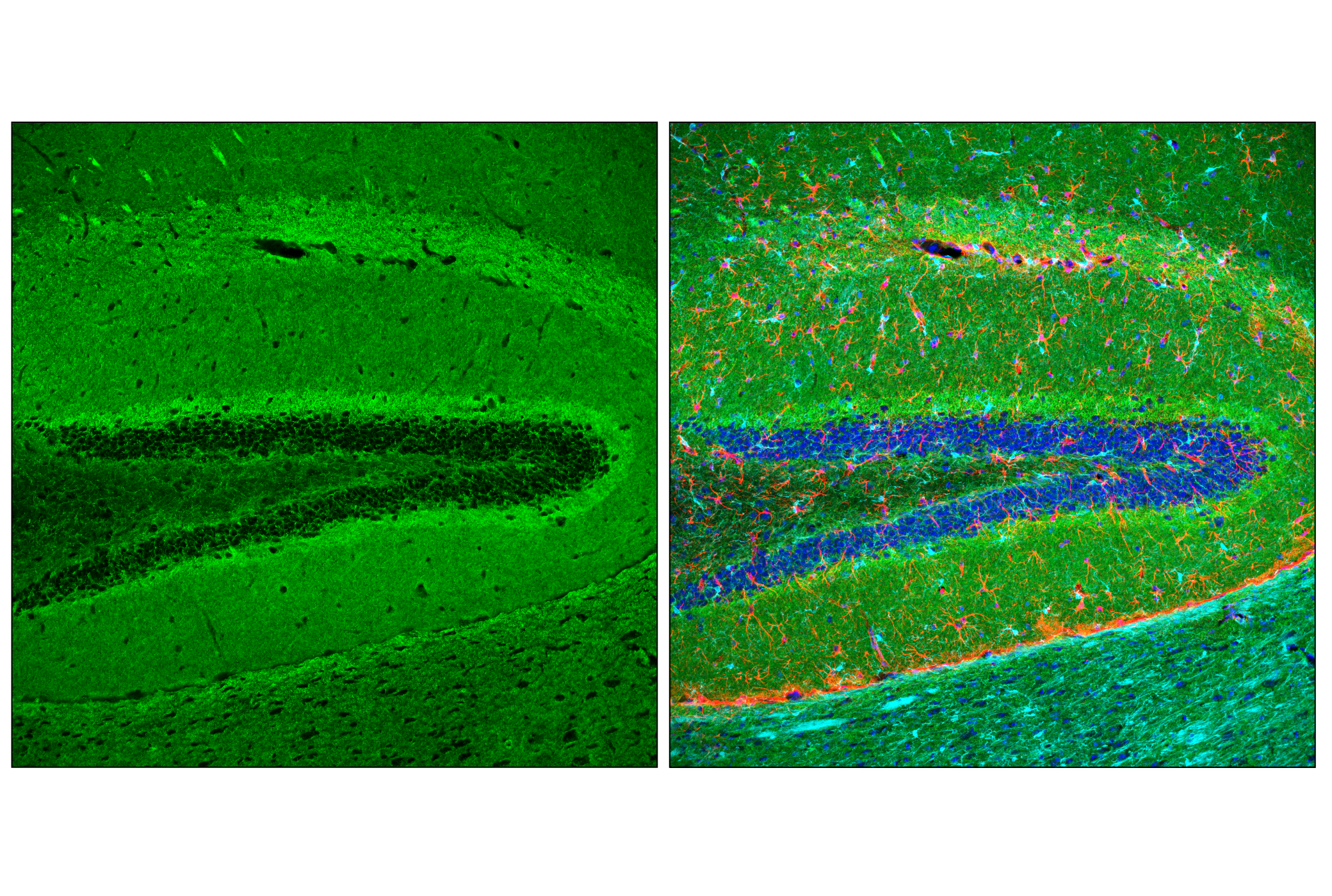 Immunofluorescence Image 2: GAP43 (E1U1D) Mouse mAb