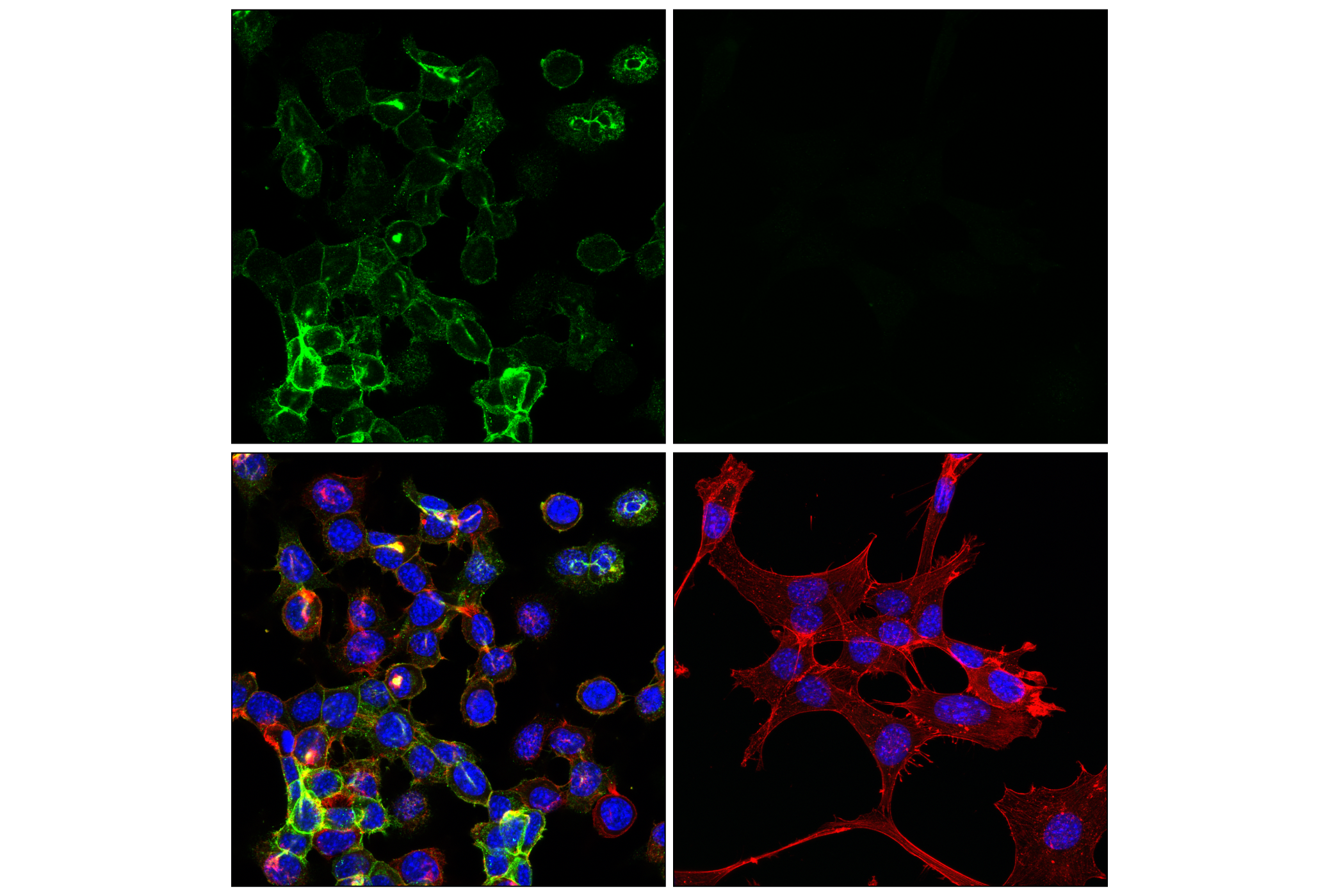 Immunofluorescence Image 3: GAP43 (E1U1D) Mouse mAb
