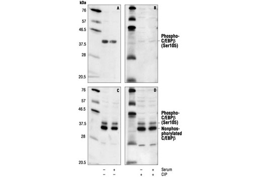 Western Blotting Image 1: Phospho-C/EBPbeta (Ser105) Antibody (Rat Specific)