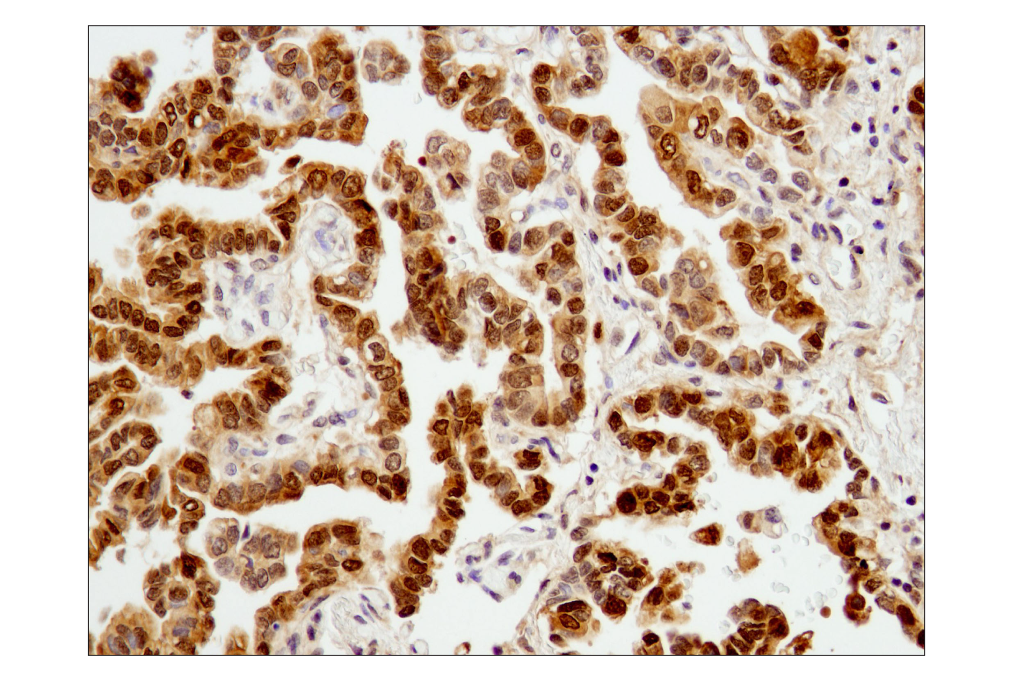 Immunohistochemistry Image 3: Stat3 (D1B2J) Rabbit mAb