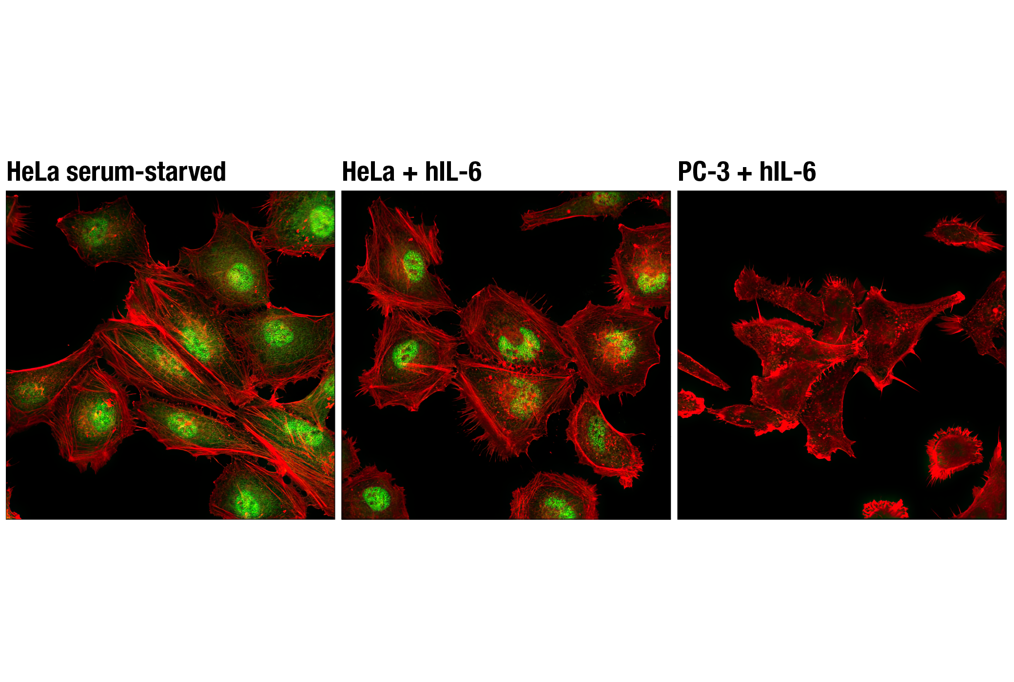 Immunofluorescence Image 1: Stat3 (D1B2J) Rabbit mAb