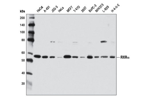  Image 4: PPARγ Regulated Fatty Acid Metabolism Antibody Sampler Kit