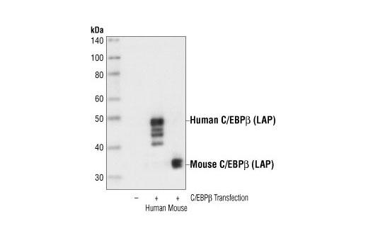Western Blotting Image 1: C/EBPβ (LAP) Antibody