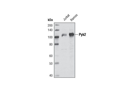 Western Blotting Image 1: Pyk2 (H364) Antibody