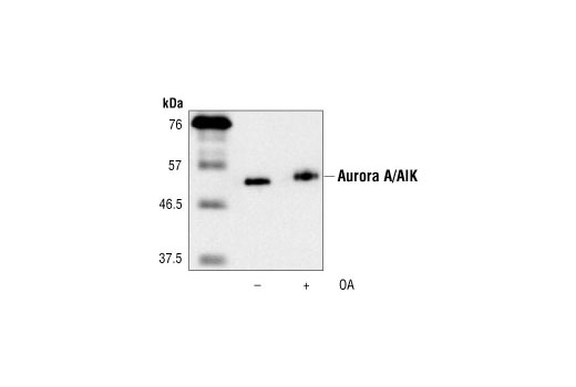 Western Blotting Image 2: Aurora A/AIK Antibody