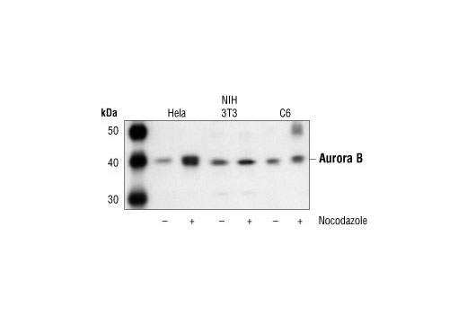 Western Blotting Image 1: Aurora B/AIM1 Antibody