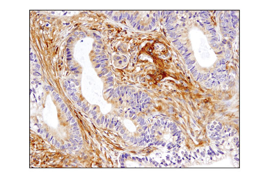 Immunohistochemistry Image 1: Talin-1 (C45F1) Rabbit mAb (BSA and Azide Free)