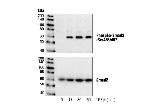 Western Blotting Image 1: Phospho-Smad2 (Ser465/467) Antibody