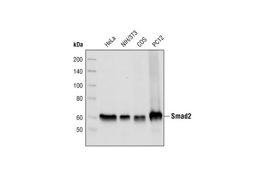 Western Blotting Image 1: Smad2 (L16D3) Mouse mAb