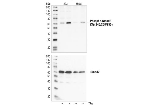 Western Blotting Image 1: Phospho-Smad2 (Ser245/250/255) Antibody