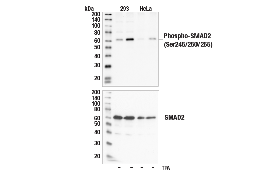Western Blotting Image 1: Phospho-SMAD2 (Ser245/250/255) Antibody