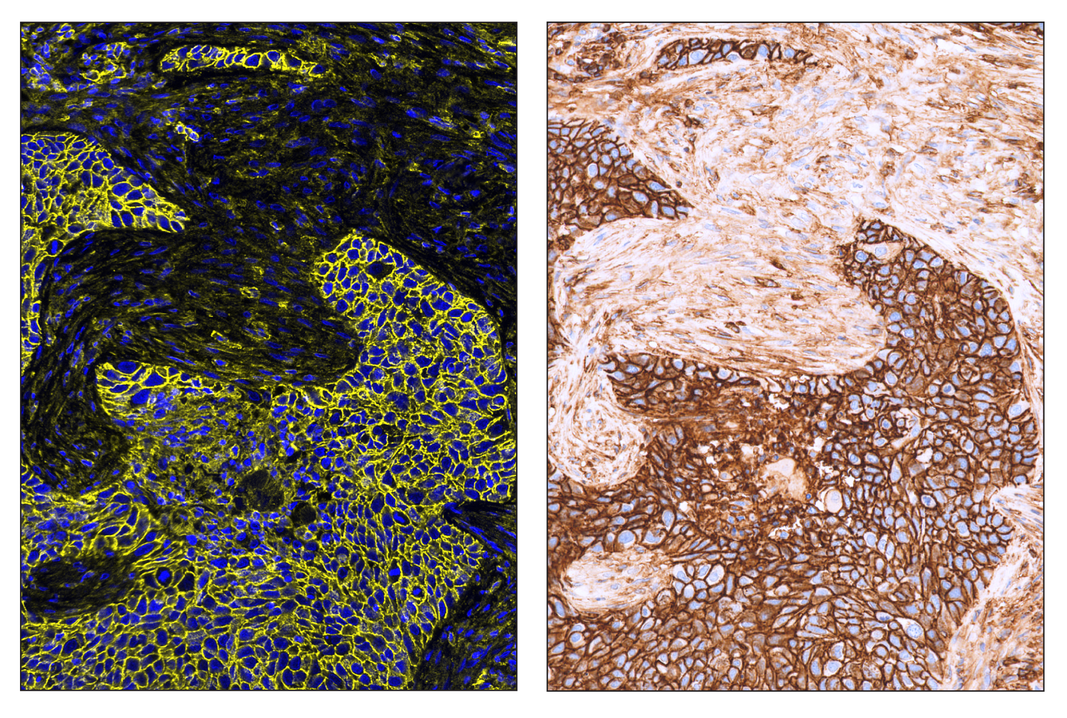 Immunohistochemistry Image 6: CD44 (E7K2Y) & CO-0030-750 SignalStar™ Oligo-Antibody Pair