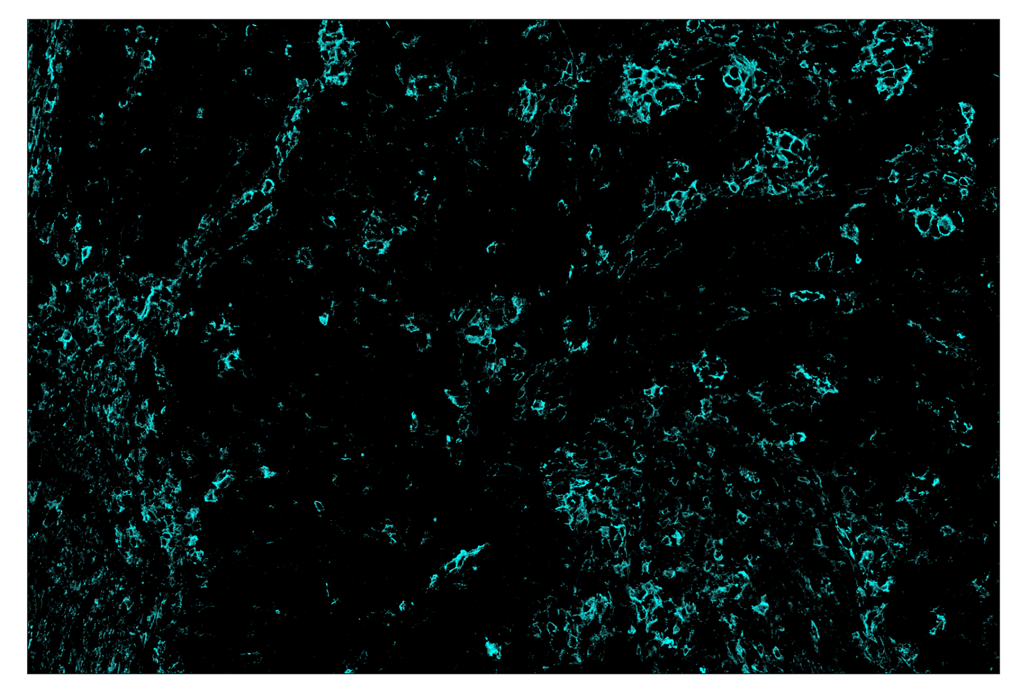 Immunohistochemistry Image 5: CD44 (E7K2Y) & CO-0030-488 SignalStar™ Oligo-Antibody Pair