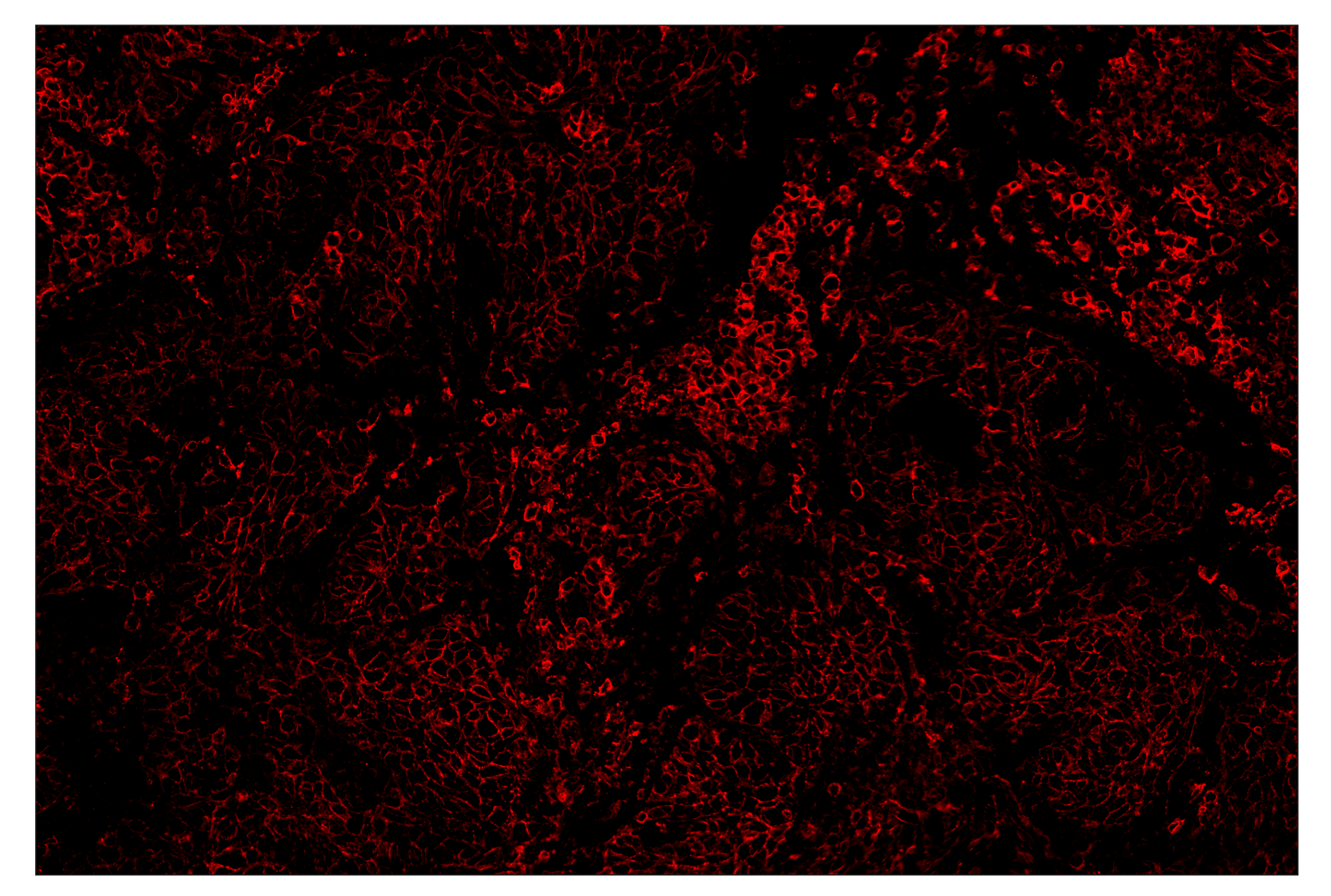 Immunohistochemistry Image 4: CD44 (E7K2Y) & CO-0030-750 SignalStar™ Oligo-Antibody Pair