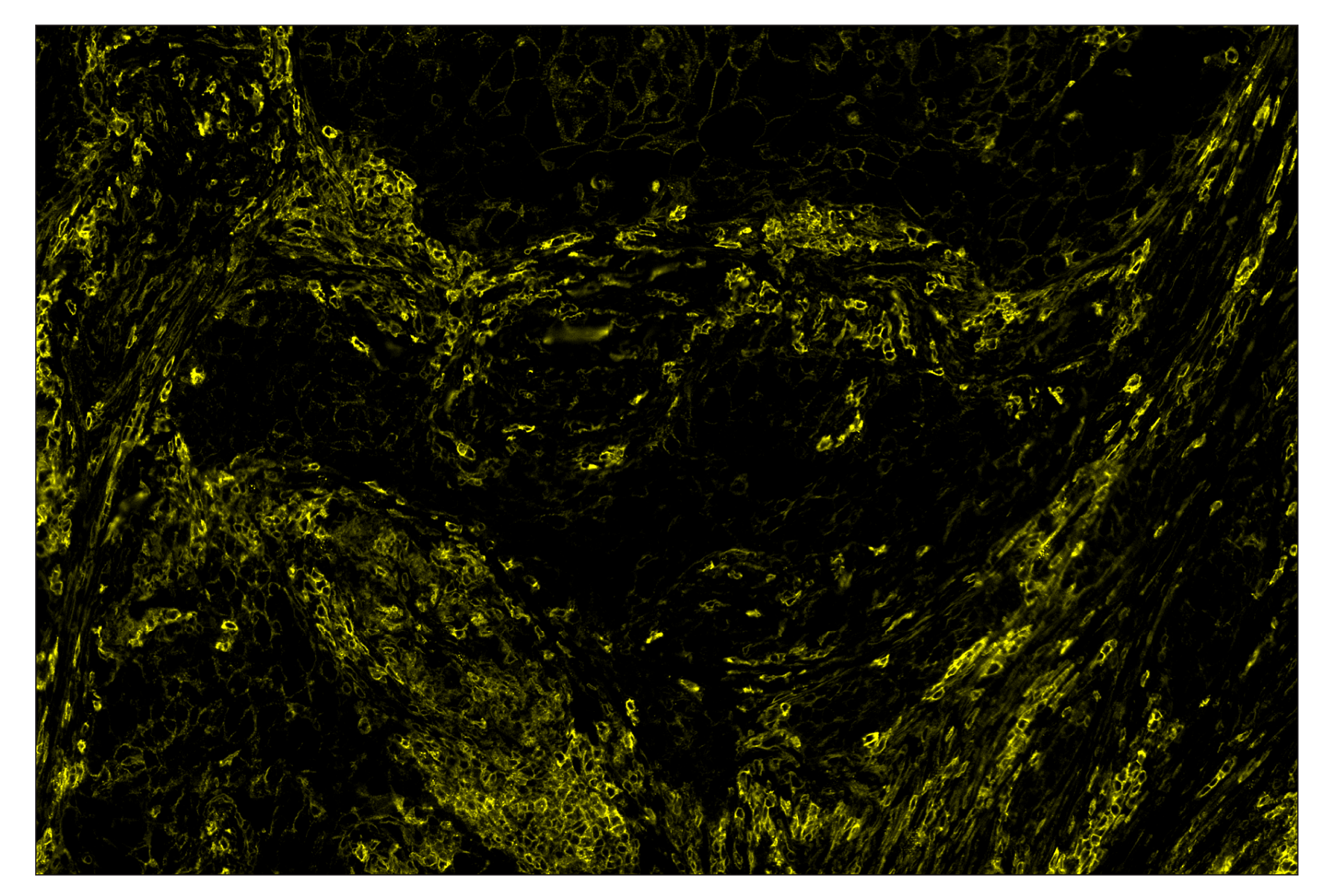 Immunohistochemistry Image 3: CD44 (E7K2Y) & CO-0030-488 SignalStar™ Oligo-Antibody Pair
