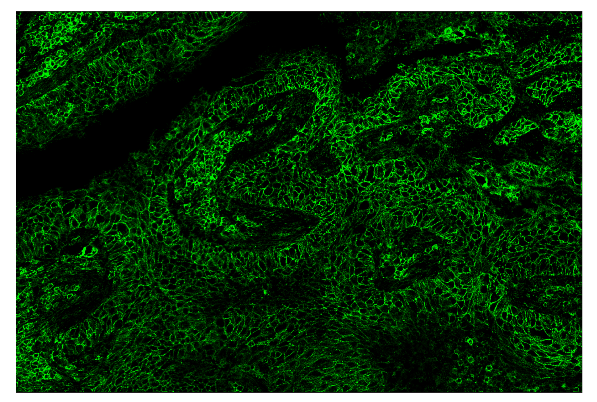 Immunohistochemistry Image 2: CD44 (E7K2Y) & CO-0030-488 SignalStar™ Oligo-Antibody Pair