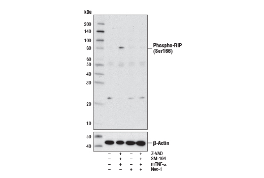 Western Blotting Image 1: Phospho-RIP (Ser166) Antibody (Rodent Specific)