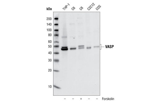 Western Blotting Image 1: VASP Antibody
