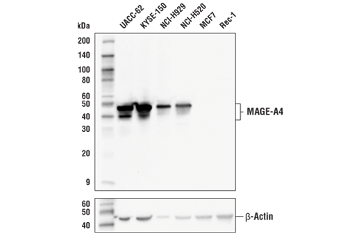 MAGE-A4 (E7O1U) XP® Rabbit mAb | Cell Signaling Technology