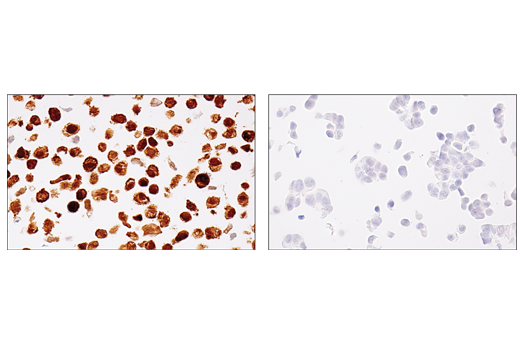 Immunohistochemistry Image 1: MAGE-A4 (E7O1U) XP® Rabbit mAb (BSA and Azide Free)