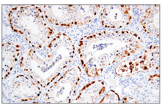 Immunohistochemistry Image 2: MAGE-A4 (E7O1U) XP® Rabbit mAb (BSA and Azide Free)