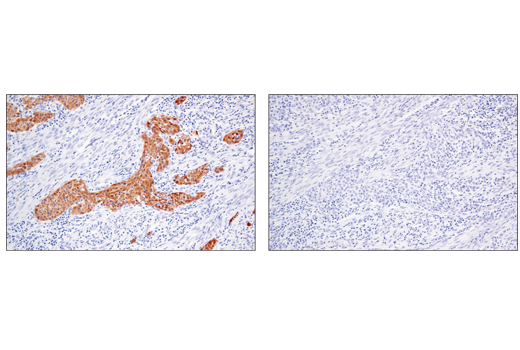 Immunohistochemistry Image 4: MAGE-A4 (E7O1U) XP® Rabbit mAb (BSA and Azide Free)