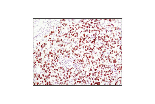 Immunohistochemistry Image 1: HNF4α (C11F12) Rabbit mAb