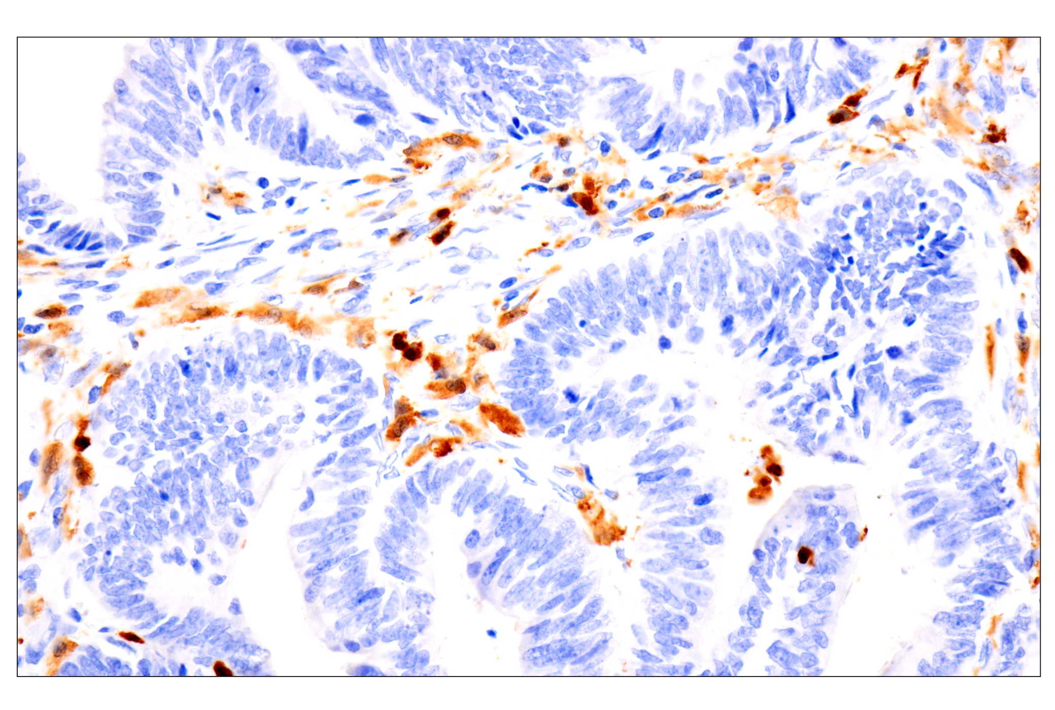 Immunohistochemistry Image 1: p47phox (F3Y6C) Rabbit mAb (BSA and Azide Free)