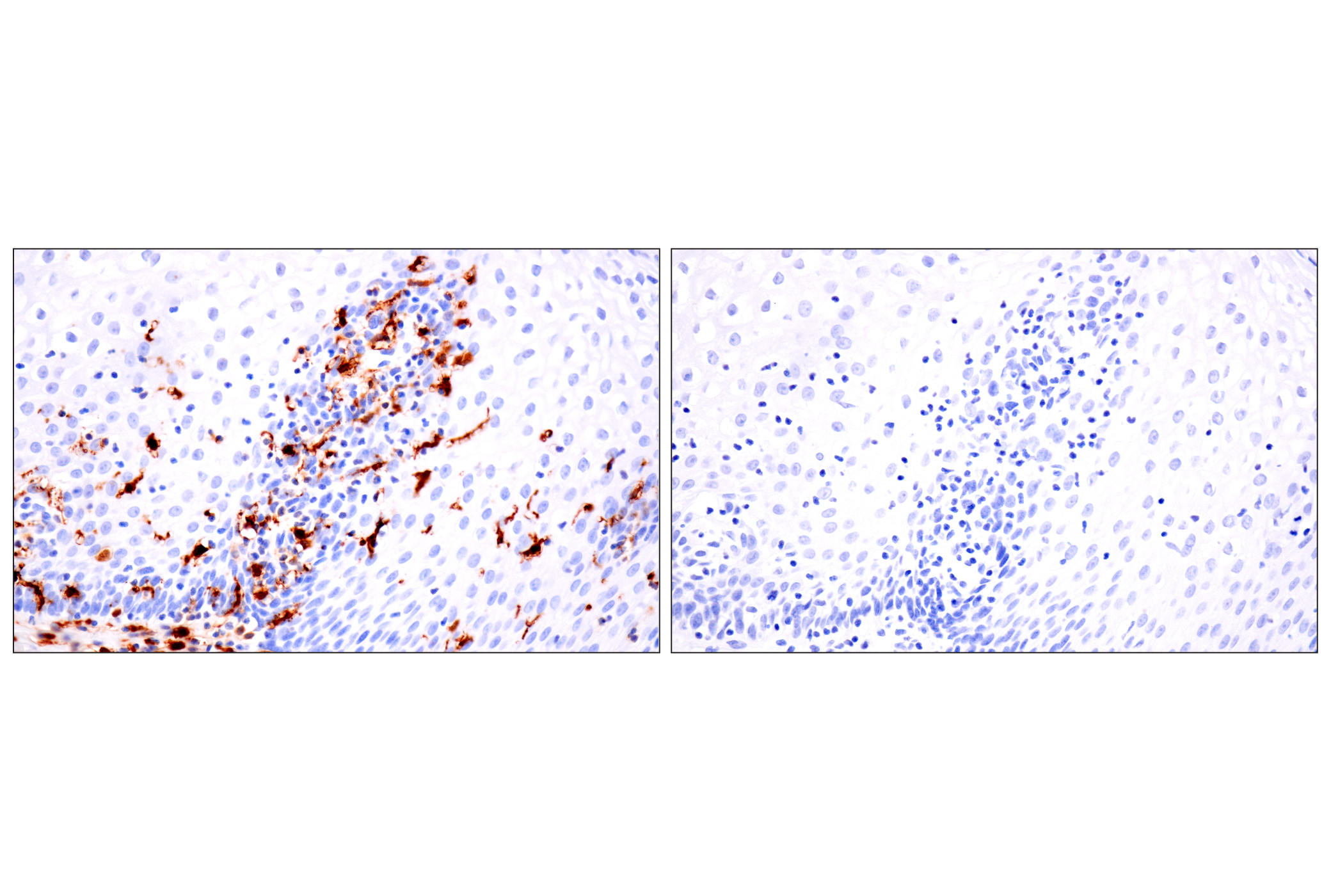 Immunohistochemistry Image 12: p47phox (F3Y6C) Rabbit mAb (BSA and Azide Free)