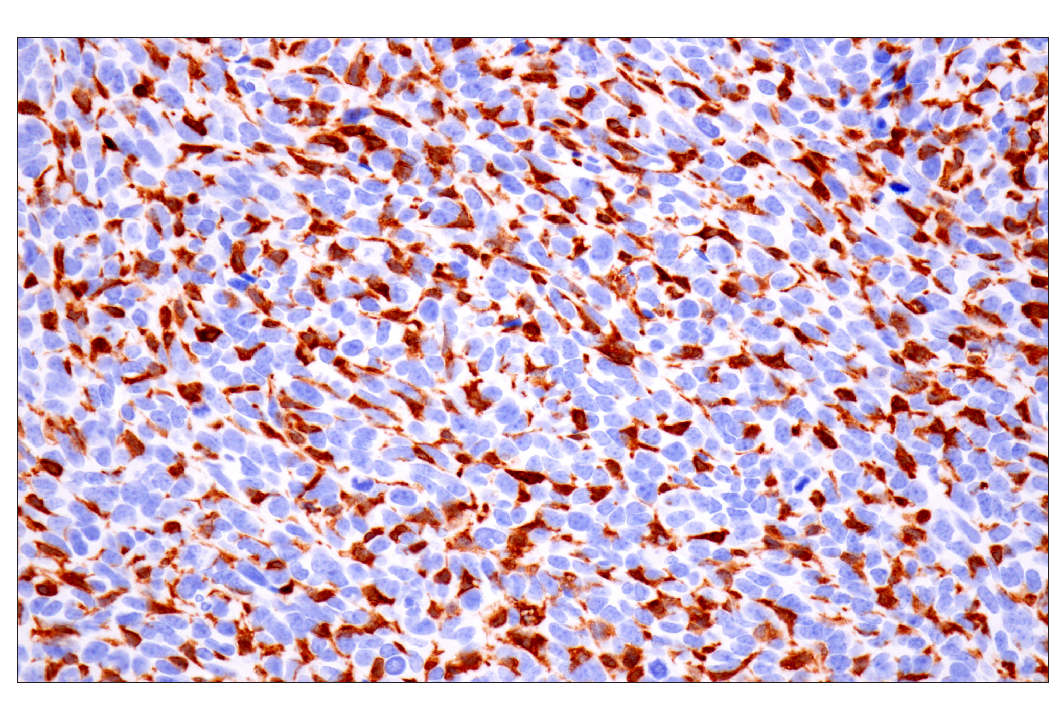 Immunohistochemistry Image 6: p47phox (F3Y6C) Rabbit mAb (BSA and Azide Free)