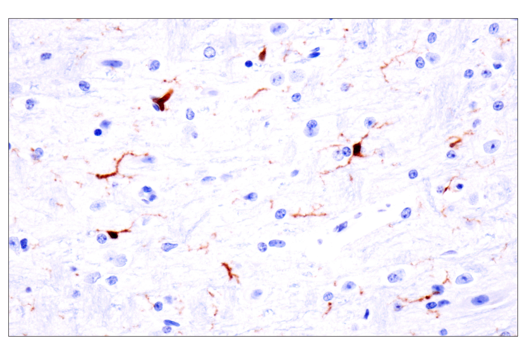 Immunohistochemistry Image 9: p47phox (F3Y6C) Rabbit mAb (BSA and Azide Free)