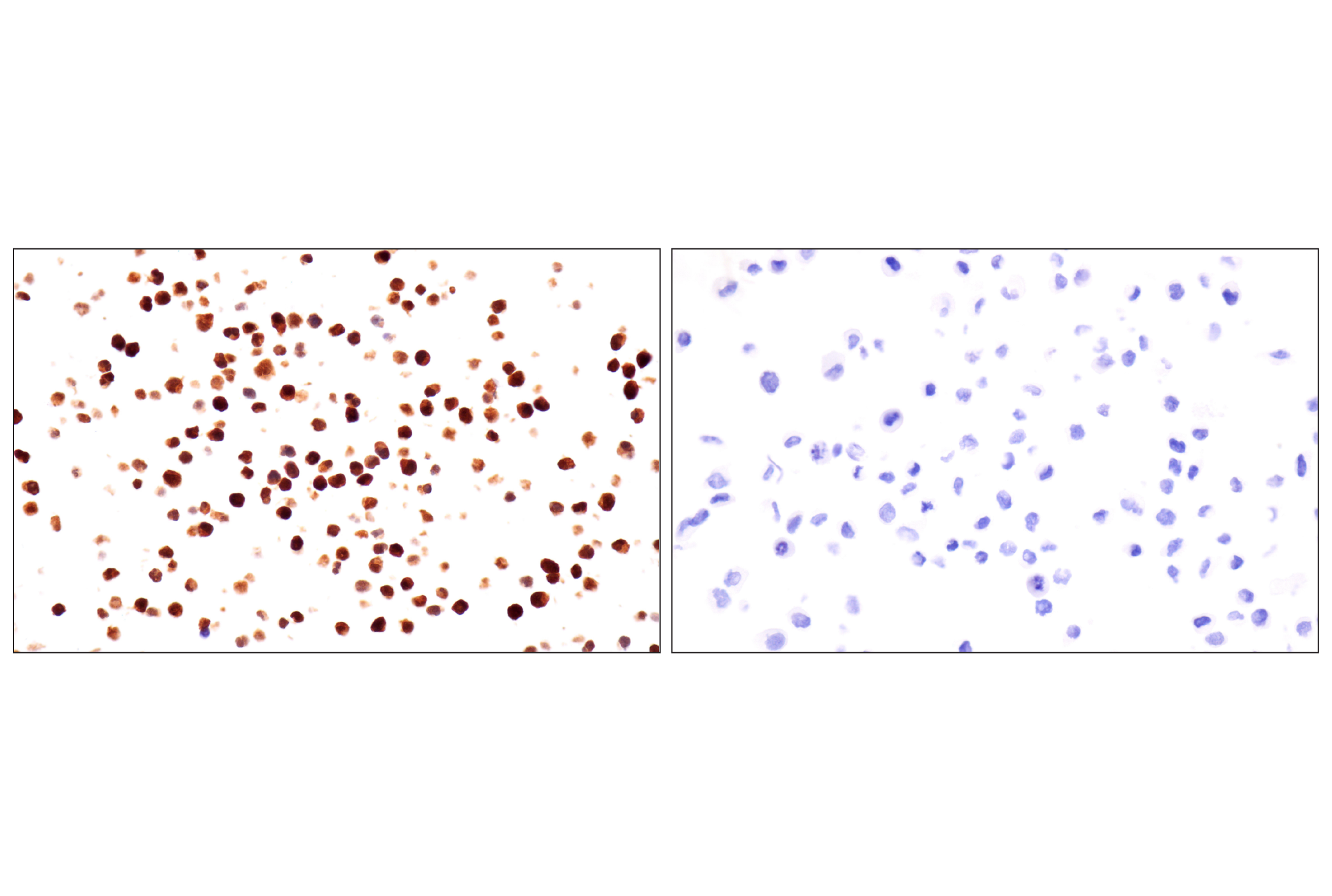 Immunohistochemistry Image 13: p47phox (F3Y6C) Rabbit mAb (BSA and Azide Free)